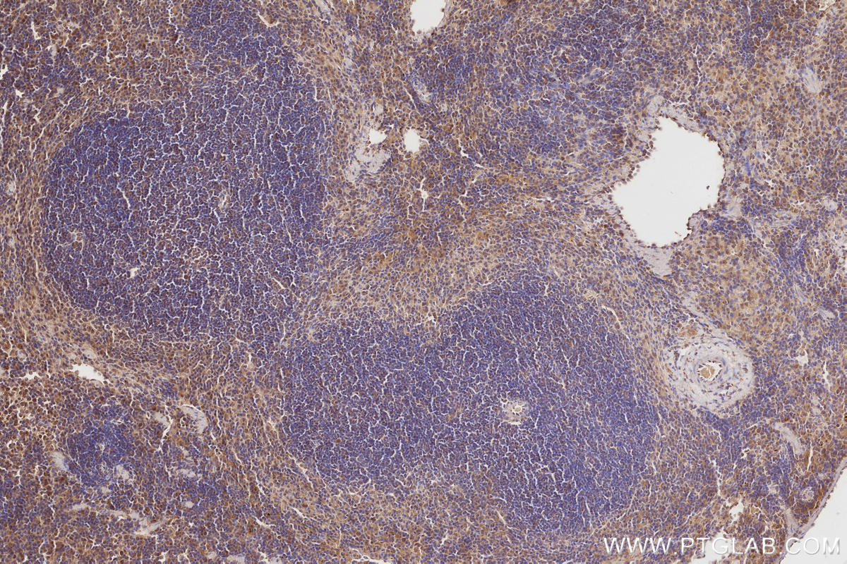 Immunohistochemistry (IHC) staining of mouse spleen tissue using ARHGAP9 Polyclonal antibody (15665-1-AP)