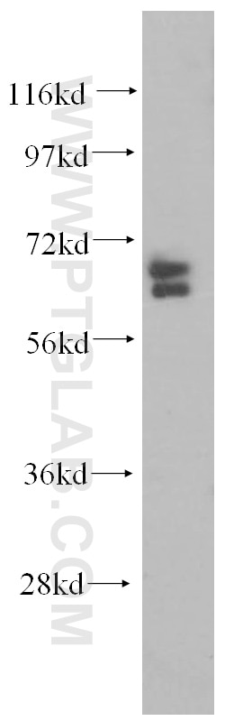 Western Blot (WB) analysis of Jurkat cells using ARHGAP9 Polyclonal antibody (15665-1-AP)