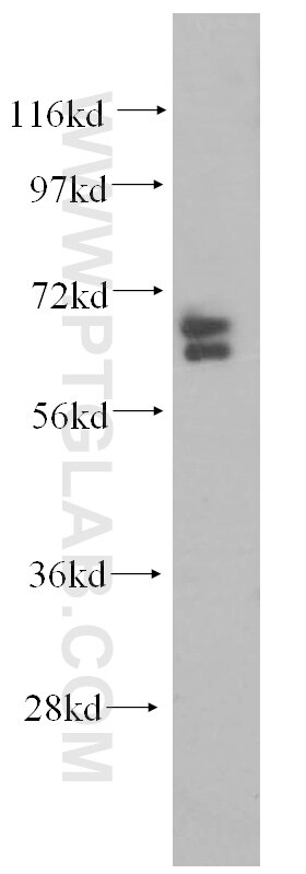 WB analysis of Jurkat using 15665-1-AP
