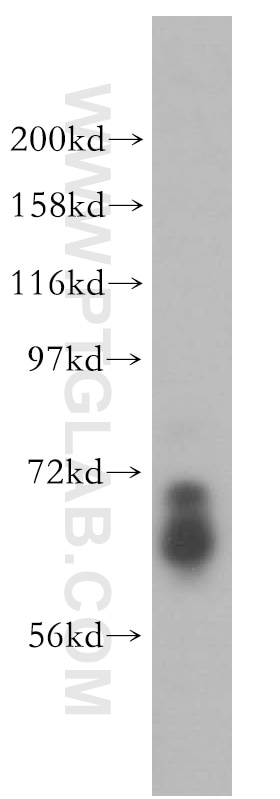 Western Blot (WB) analysis of HL-60 cells using ARHGAP9 Polyclonal antibody (15665-1-AP)