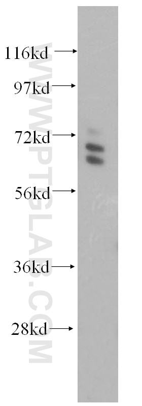 Western Blot (WB) analysis of HeLa cells using ARHGAP9 Polyclonal antibody (15665-1-AP)
