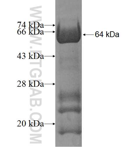 ARHGAP9 fusion protein Ag8104 SDS-PAGE