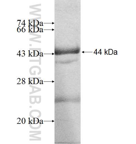 ARHGAP9 fusion protein Ag8157 SDS-PAGE
