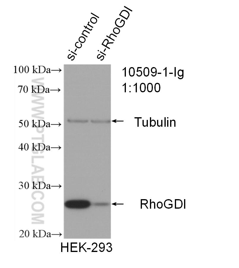 Western Blot (WB) analysis of HEK-293 cells using RhoGDI Polyclonal antibody (10509-1-Ig)