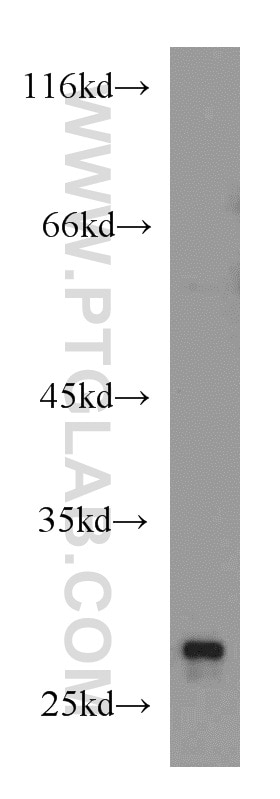 Western Blot (WB) analysis of Jurkat cells using RhoGDI Polyclonal antibody (10509-1-Ig)