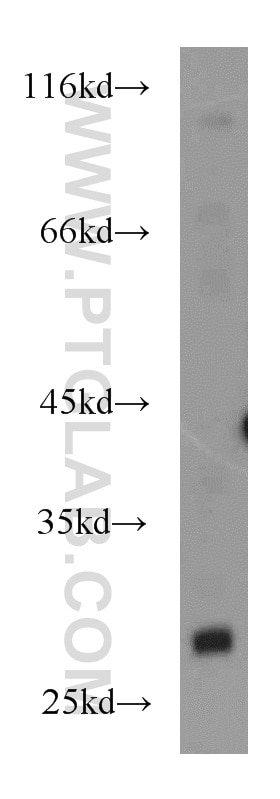 Western Blot (WB) analysis of A431 cells using RhoGDI Polyclonal antibody (10509-1-Ig)