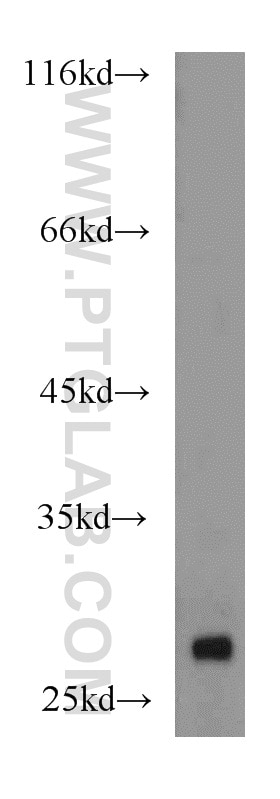 Western Blot (WB) analysis of mouse pancreas tissue using RhoGDI Polyclonal antibody (10509-1-Ig)