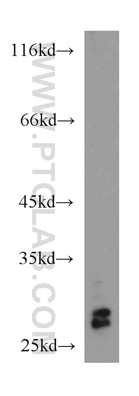 Western Blot (WB) analysis of HL-60 cells using RhoGDI Polyclonal antibody (10509-1-Ig)