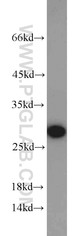 Western Blot (WB) analysis of HeLa cells using RhoGDI Polyclonal antibody (10509-1-Ig)