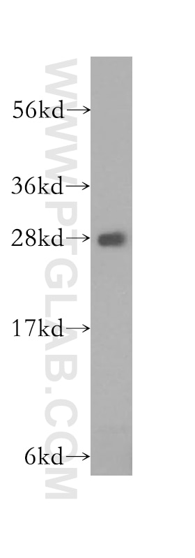 Western Blot (WB) analysis of HEK-293 cells using RhoGDI Polyclonal antibody (10509-1-Ig)