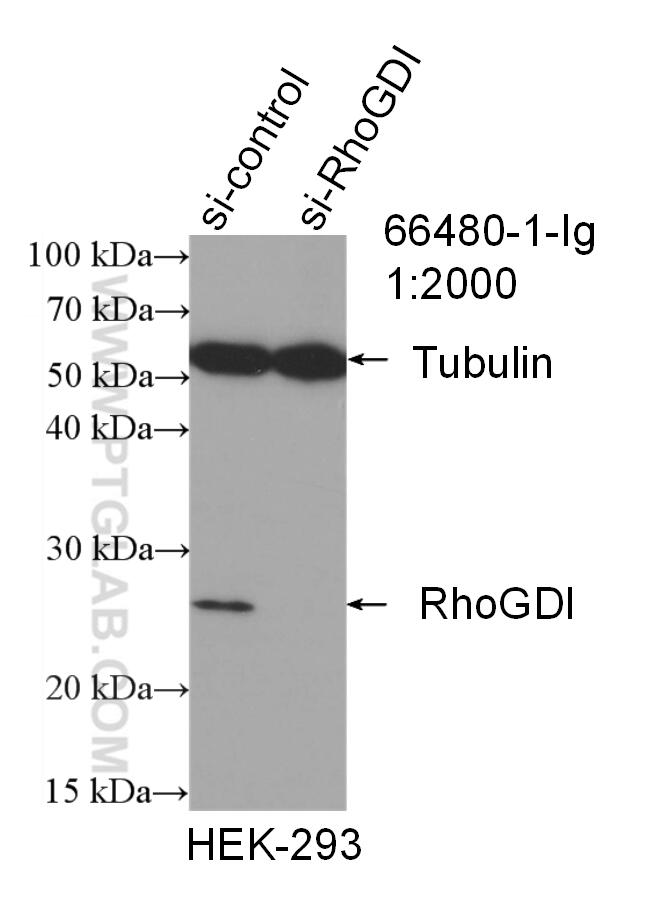 Western Blot (WB) analysis of HEK-293 cells using RhoGDI Monoclonal antibody (66480-1-Ig)