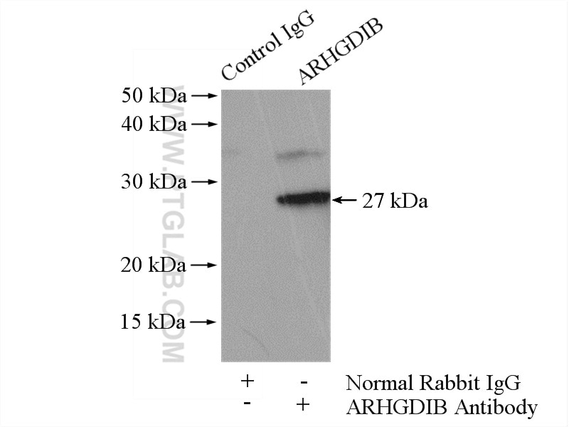 Immunoprecipitation (IP) experiment of Raji cells using ARHGDIB Polyclonal antibody (16122-1-AP)