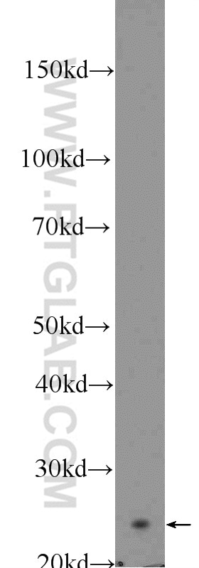 Western Blot (WB) analysis of rat spleen tissue using ARHGDIB Polyclonal antibody (16122-1-AP)