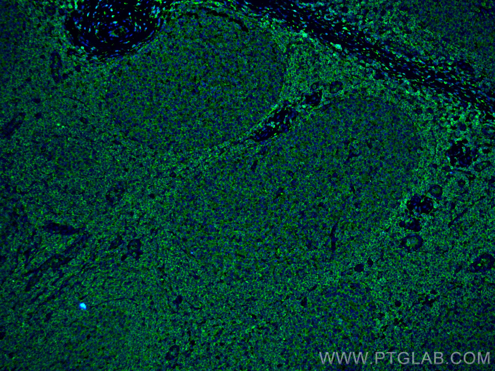 Immunofluorescence (IF) / fluorescent staining of human tonsillitis tissue using ARHGDIB Monoclonal antibody (66054-1-Ig)
