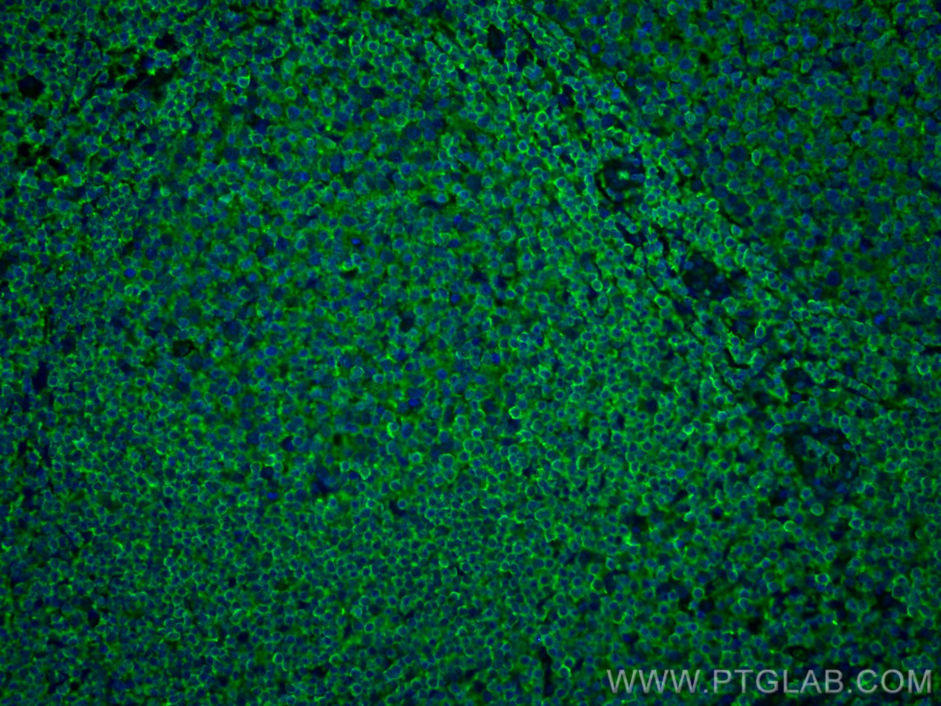 Immunofluorescence (IF) / fluorescent staining of human tonsillitis tissue using ARHGDIB Monoclonal antibody (66054-1-Ig)