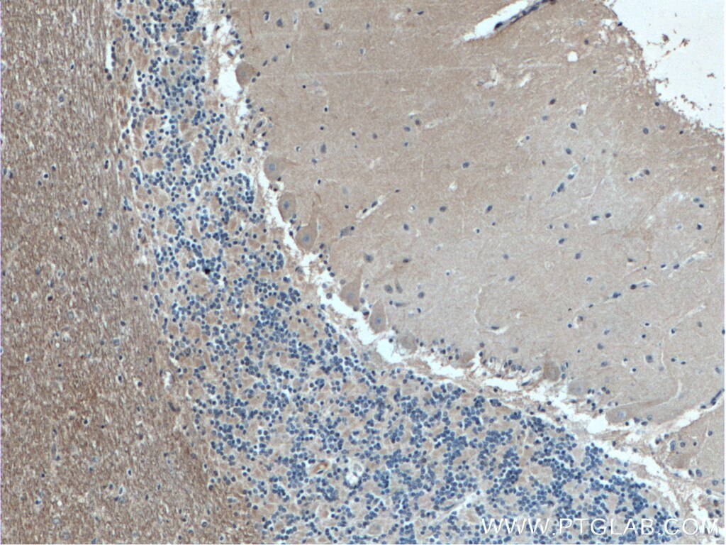 Immunohistochemistry (IHC) staining of human cerebellum tissue using ARHGDIB Monoclonal antibody (66054-1-Ig)