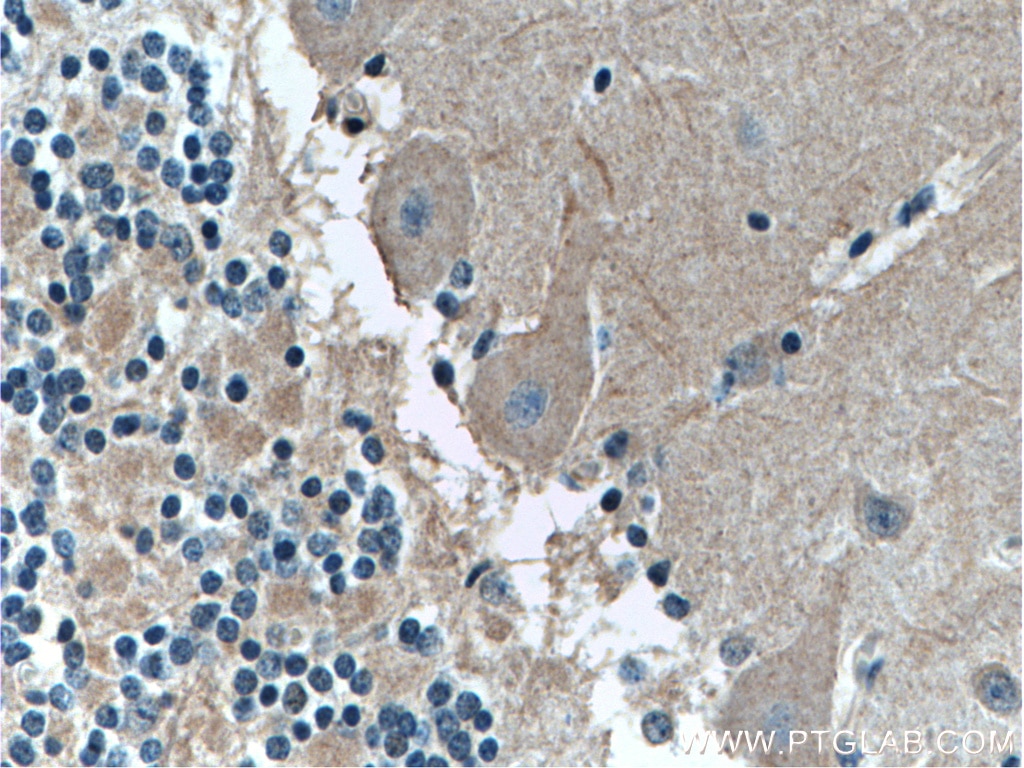 IHC staining of human cerebellum using 66054-1-Ig