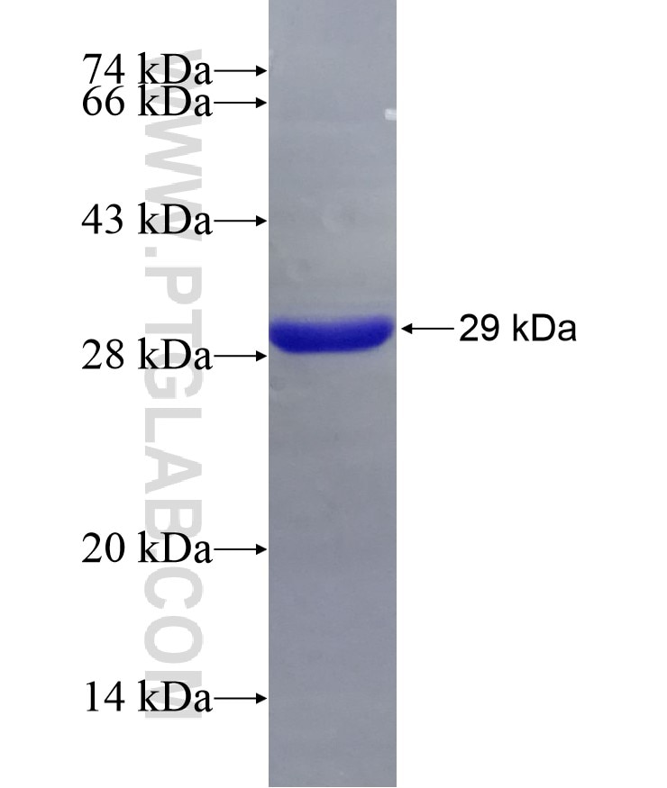 ARHGDIB fusion protein Ag9091 SDS-PAGE