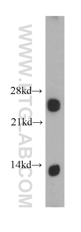 Western Blot (WB) analysis of human brain tissue using ARHGDIG Polyclonal antibody (14282-1-AP)