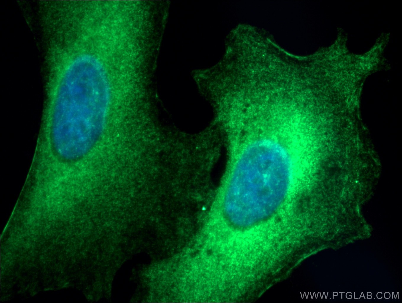 Immunofluorescence (IF) / fluorescent staining of A549 cells using ARHGEF1 Polyclonal antibody (11363-1-AP)