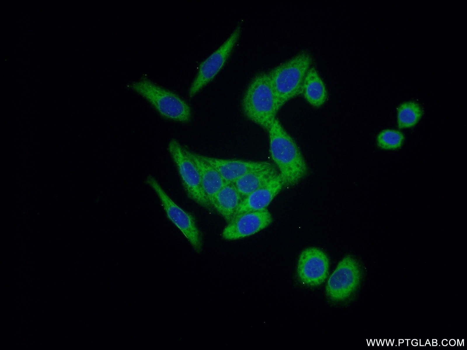 Immunofluorescence (IF) / fluorescent staining of HeLa cells using ARHGEF1 Polyclonal antibody (11363-1-AP)