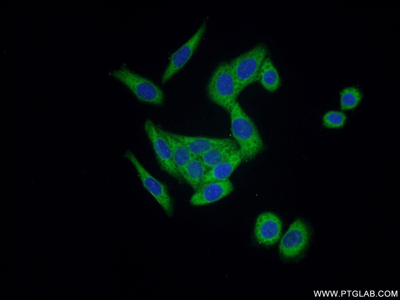 IF Staining of HeLa using 11363-1-AP