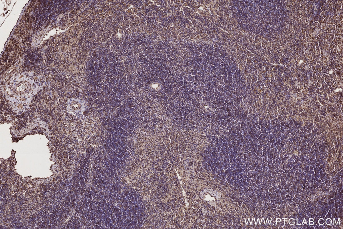 Immunohistochemistry (IHC) staining of mouse spleen tissue using ARHGEF1 Polyclonal antibody (11363-1-AP)