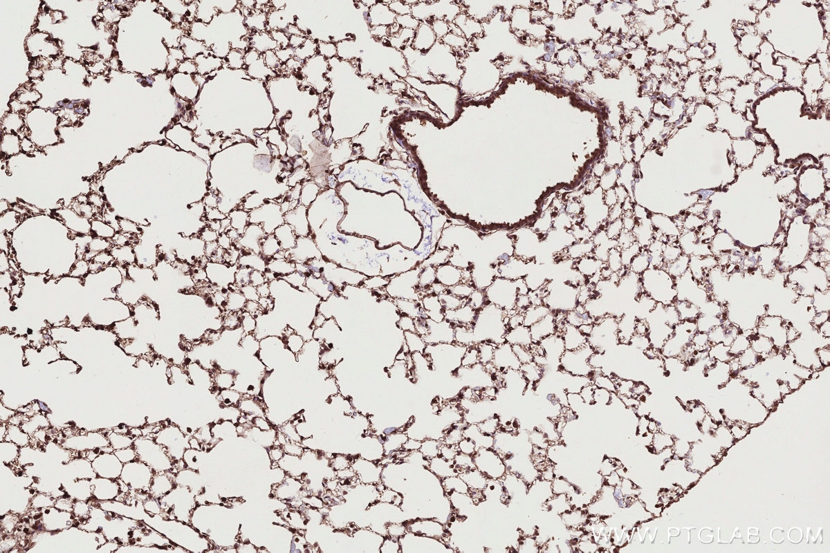 Immunohistochemistry (IHC) staining of mouse lung tissue using ARHGEF1 Polyclonal antibody (11363-1-AP)