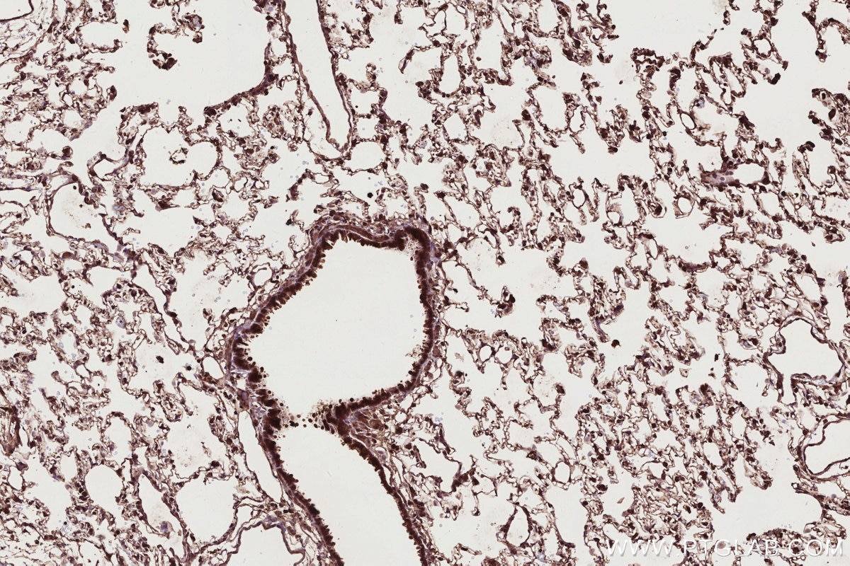 Immunohistochemistry (IHC) staining of rat lung tissue using ARHGEF1 Polyclonal antibody (11363-1-AP)