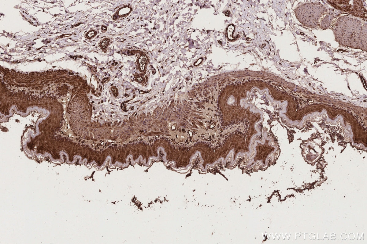 Immunohistochemistry (IHC) staining of rat stomach tissue using ARHGEF1 Polyclonal antibody (11363-1-AP)