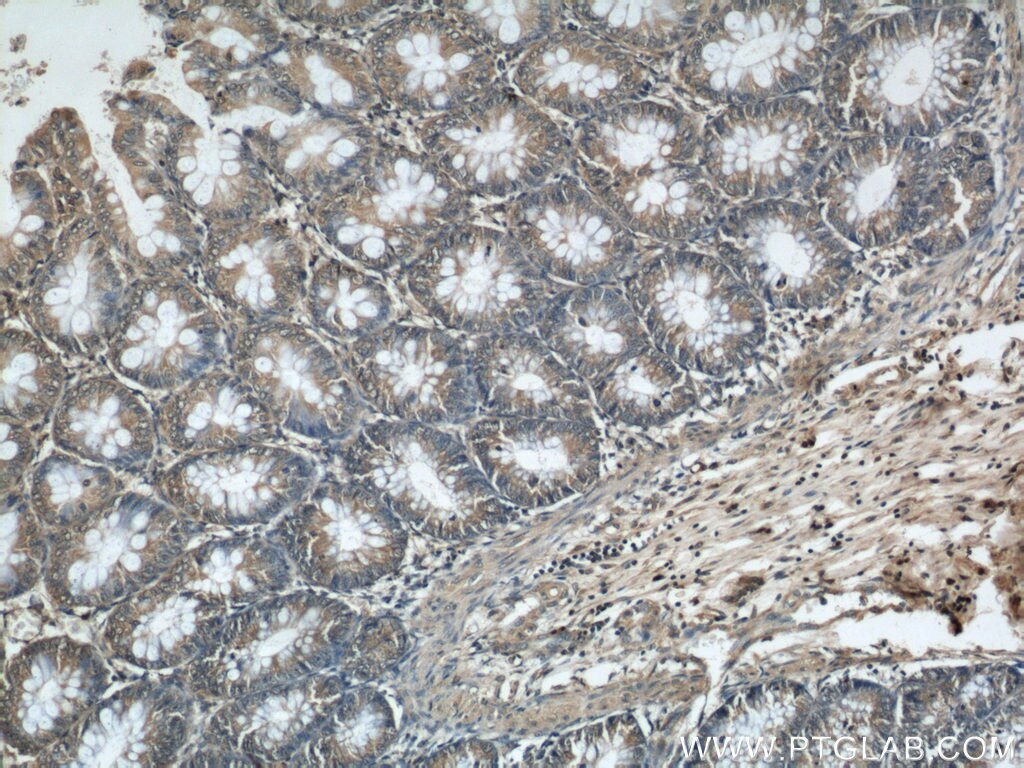 Immunohistochemistry (IHC) staining of human colon tissue using ARHGEF1 Polyclonal antibody (11363-1-AP)