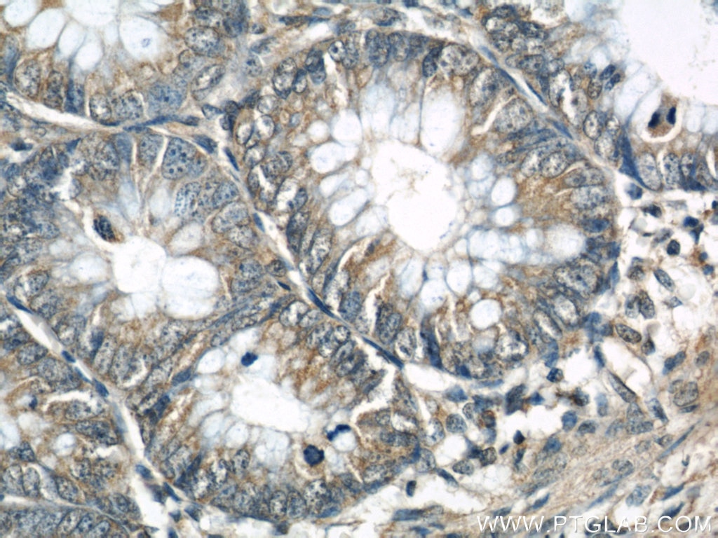 IHC staining of human colon using 11363-1-AP