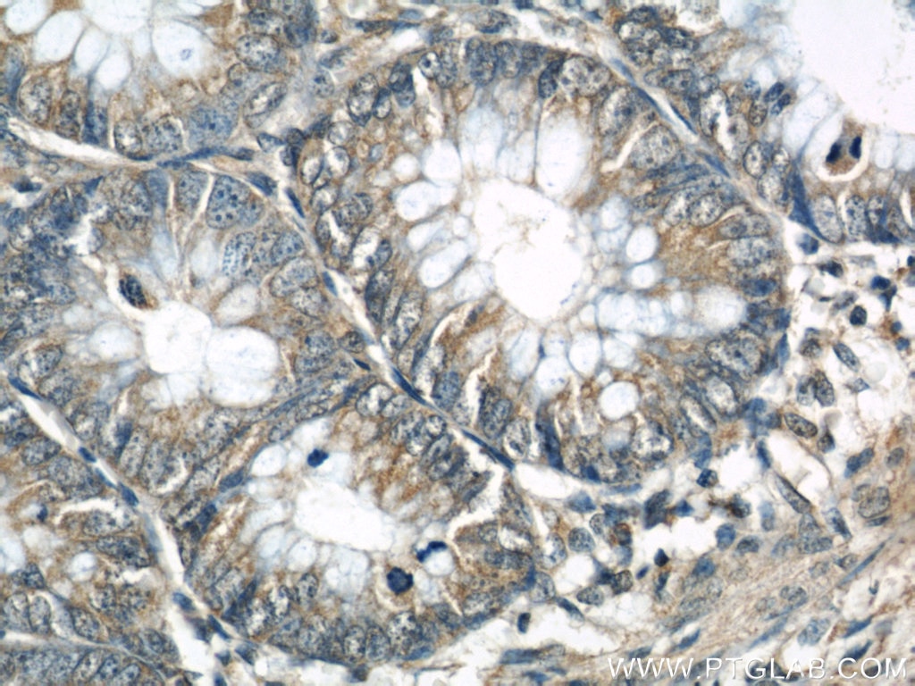 Immunohistochemistry (IHC) staining of human colon tissue using ARHGEF1 Polyclonal antibody (11363-1-AP)