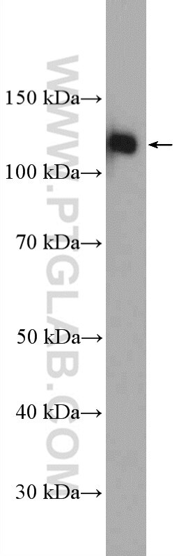 Western Blot (WB) analysis of HepG2 cells using ARHGEF1 Polyclonal antibody (11363-1-AP)