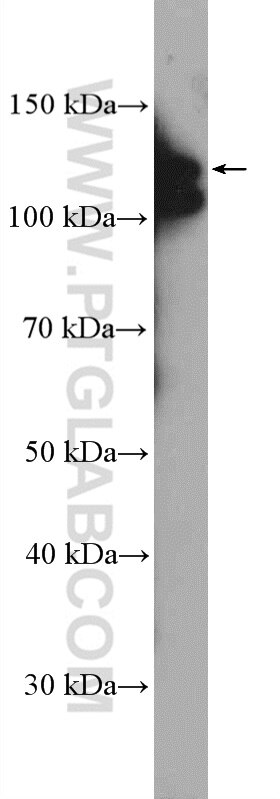 Western Blot (WB) analysis of Jurkat cells using ARHGEF1 Polyclonal antibody (11363-1-AP)