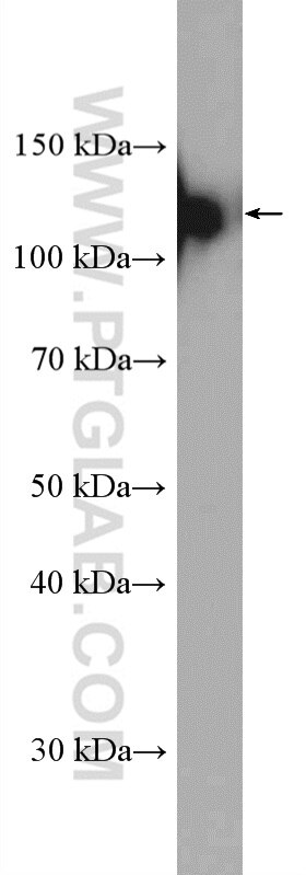 WB analysis of HeLa using 11363-1-AP