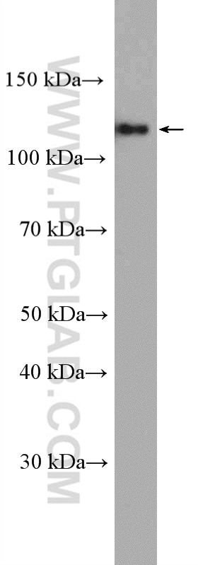 Western Blot (WB) analysis of K-562 cells using ARHGEF1 Polyclonal antibody (11363-1-AP)