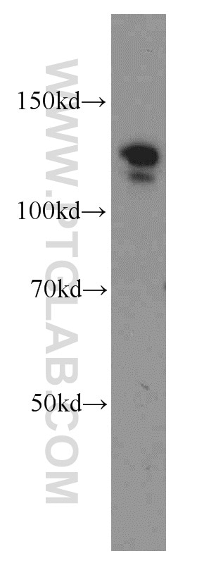 Western Blot (WB) analysis of mouse spleen tissue using ARHGEF1 Polyclonal antibody (11363-1-AP)