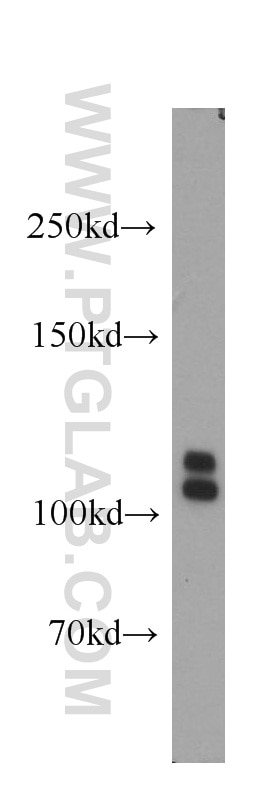 Western Blot (WB) analysis of human brain tissue using ARHGEF1 Polyclonal antibody (11363-1-AP)