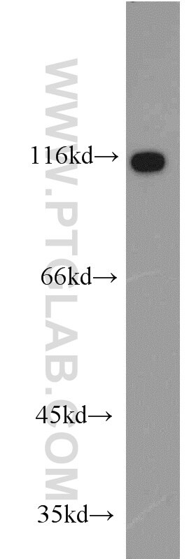 Western Blot (WB) analysis of HEK-293 cells using ARHGEF1 Polyclonal antibody (11363-1-AP)