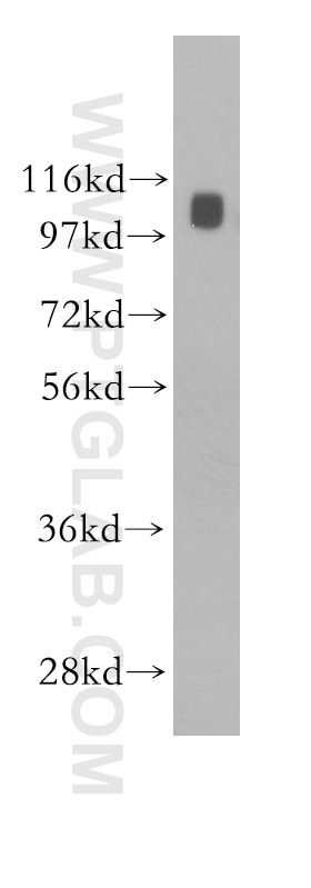 Western Blot (WB) analysis of human spleen tissue using ARHGEF1 Polyclonal antibody (11363-1-AP)