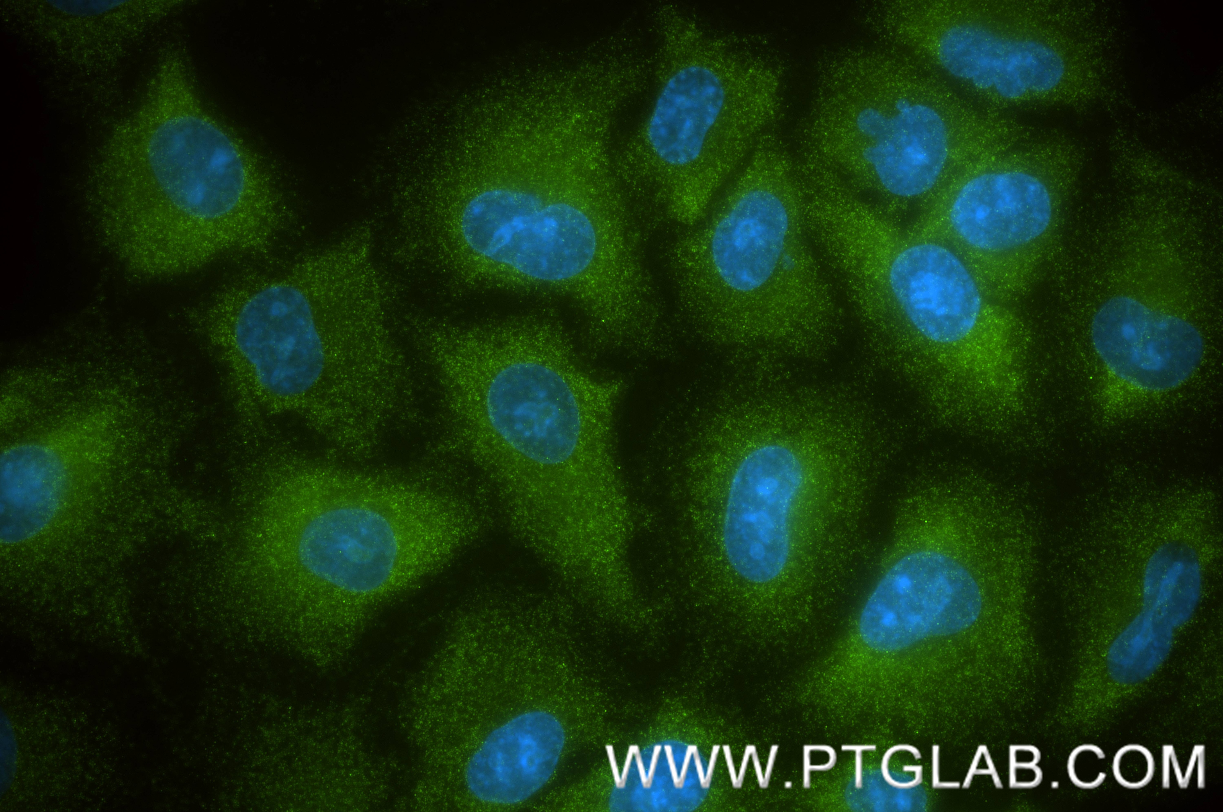 IF Staining of A549 using 88129-1-RR (same clone as 88129-1-PBS) Immunofluorescence (IF) / fluorescent staining of A549 cells using ARHGEF1 Recombinant monoclonal antibody (88129-1-RR)