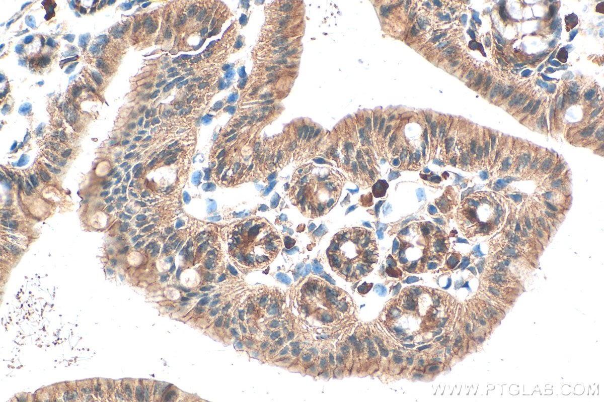 Immunohistochemistry (IHC) staining of mouse colon tissue using ARHGEF11 Polyclonal antibody (30508-1-AP)