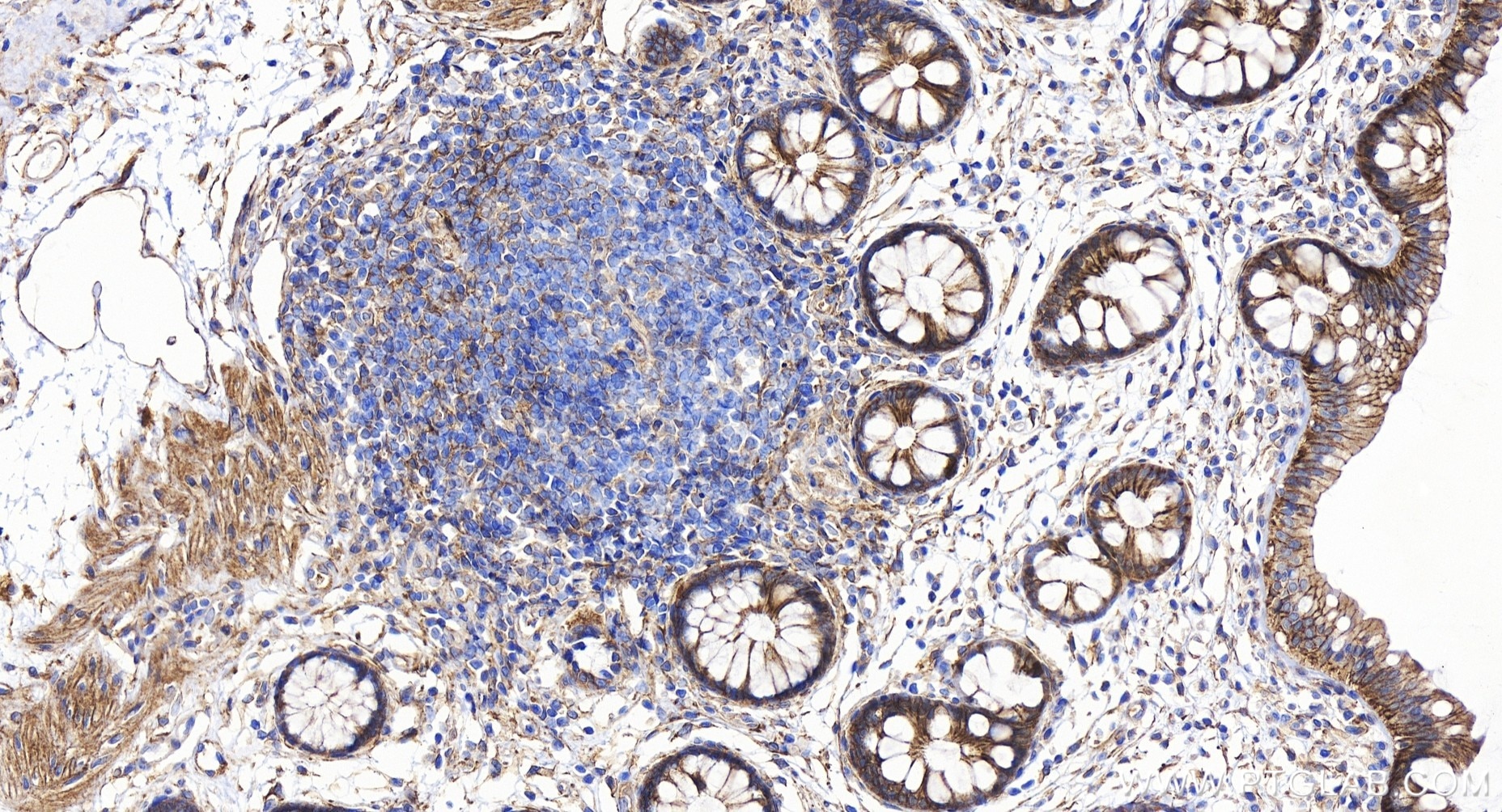Immunohistochemistry (IHC) staining of human colon tissue using ARHGEF11 Recombinant antibody (84149-1-RR)
