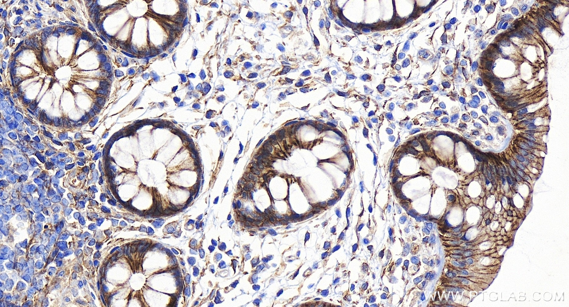Immunohistochemistry (IHC) staining of human colon tissue using ARHGEF11 Recombinant antibody (84149-1-RR)