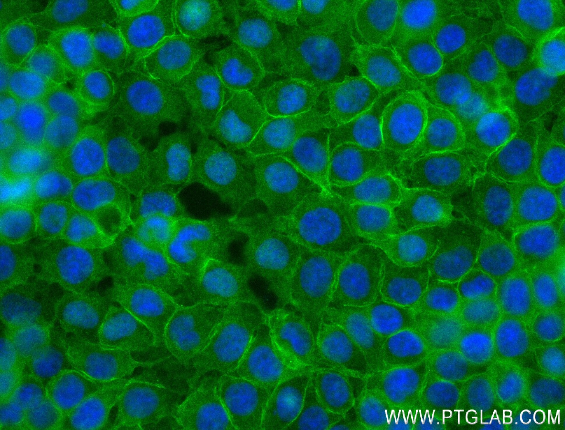 Immunofluorescence (IF) / fluorescent staining of HuH-7 cells using ARHGEF11 Recombinant antibody (84149-1-RR)