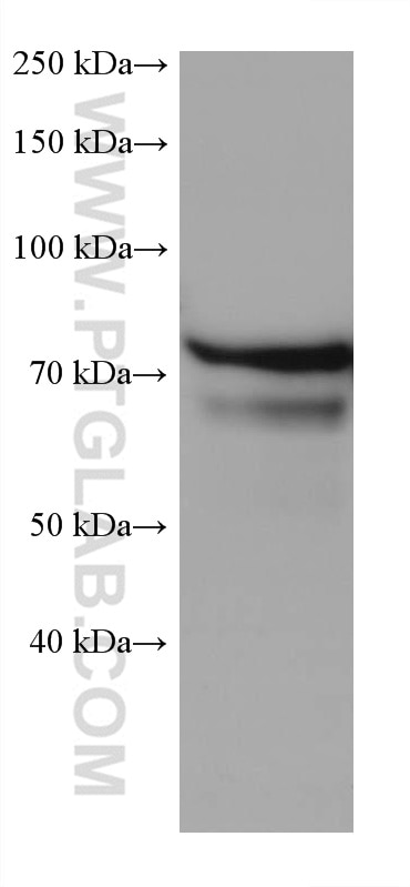 Western Blot (WB) analysis of MCF-7 cells using ARHGEF16 Monoclonal antibody (67975-1-Ig)