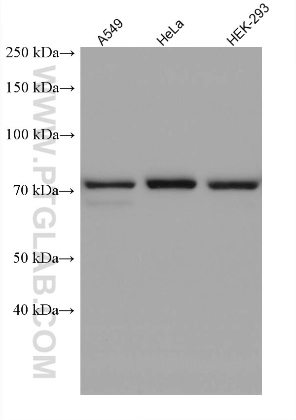 Western Blot (WB) analysis of various lysates using ARHGEF16 Monoclonal antibody (67975-1-Ig)