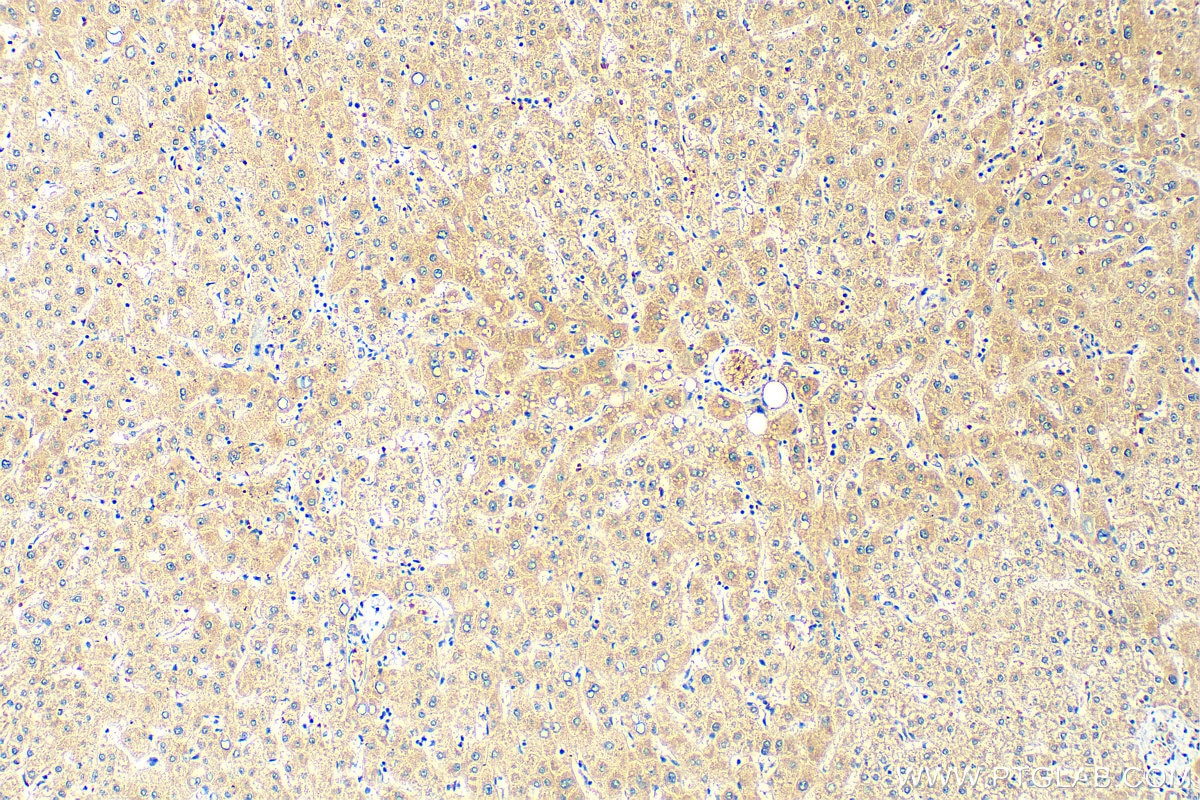 Immunohistochemistry (IHC) staining of human liver tissue using ARHGEF17 Polyclonal antibody (20021-1-AP)