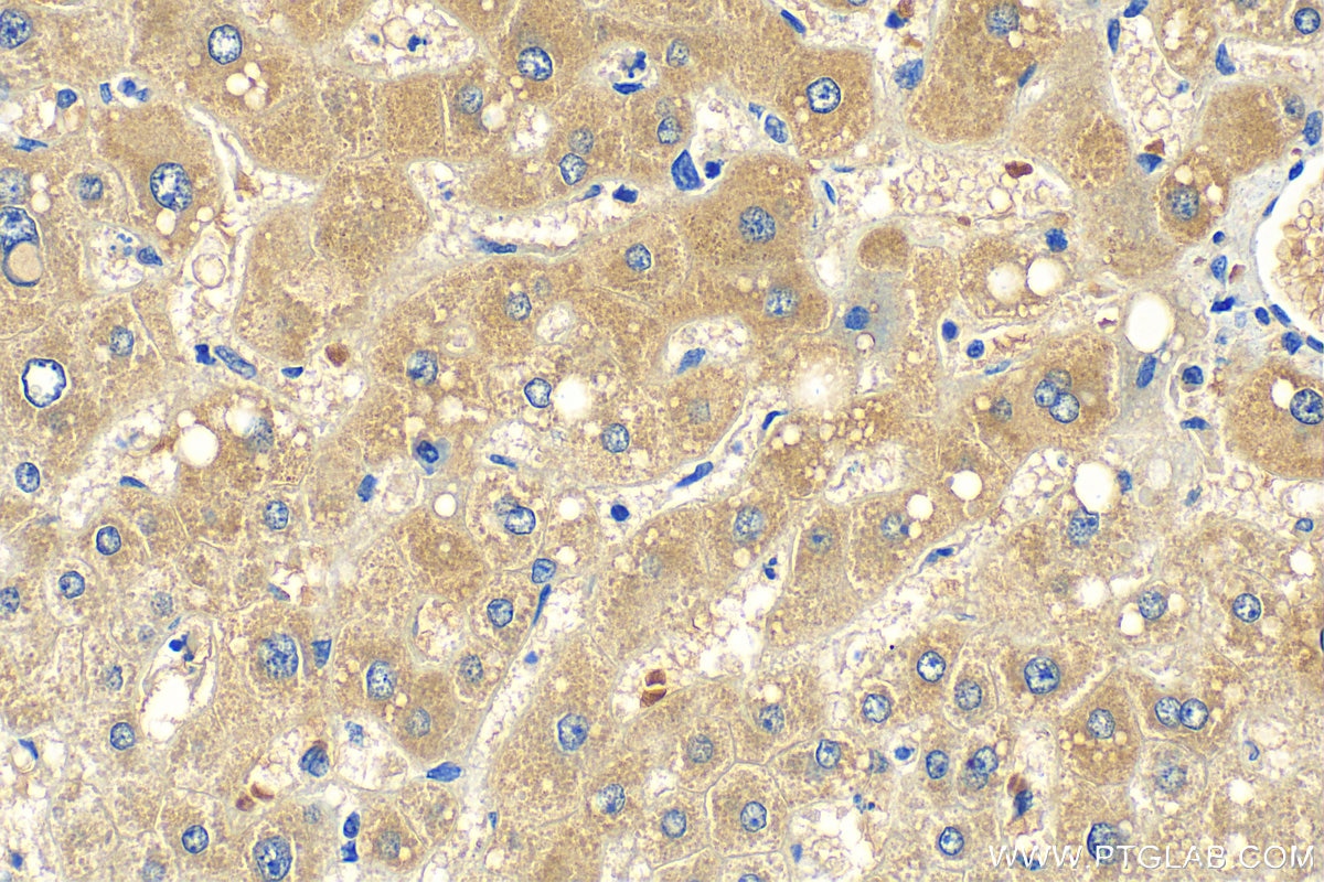 Immunohistochemistry (IHC) staining of human liver tissue using ARHGEF17 Polyclonal antibody (20021-1-AP)